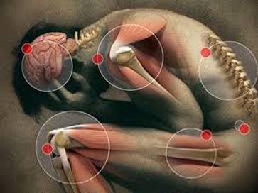 Oltre il dolore: il legame sorprendente tra fibromialgia e tossine
